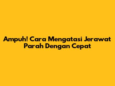 Ampuh! Cara Mengatasi Jerawat Parah Dengan Cepat