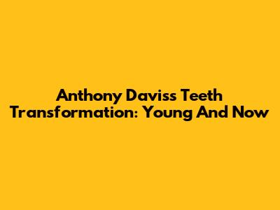 Anthony Davis's Teeth Transformation: Young And Now