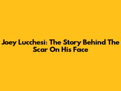 Joey Lucchesi: The Story Behind The Scar On His Face