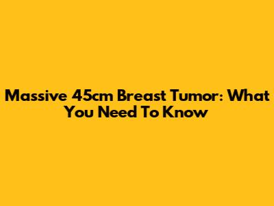 Massive 45cm Breast Tumor: What You Need To Know