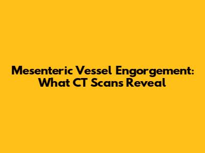 Mesenteric Vessel Engorgement: What CT Scans Reveal