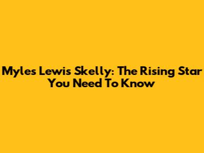 Myles Lewis Skelly: The Rising Star You Need To Know